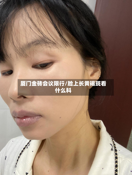厦门金砖会议限行/脸上长黄褐斑看什么科